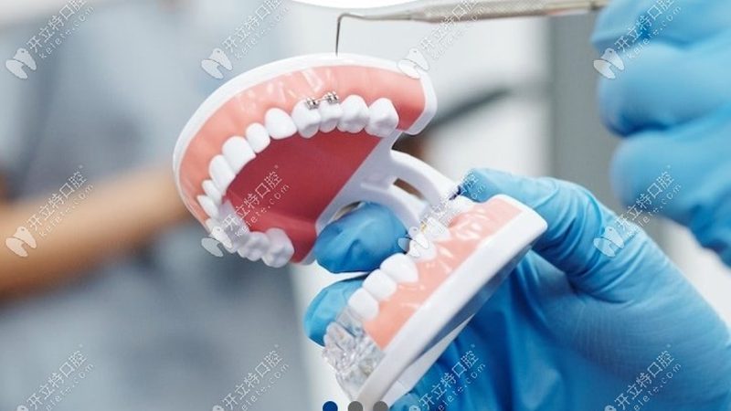老人镶牙新选择：BPS吸附性义齿的性价比考量