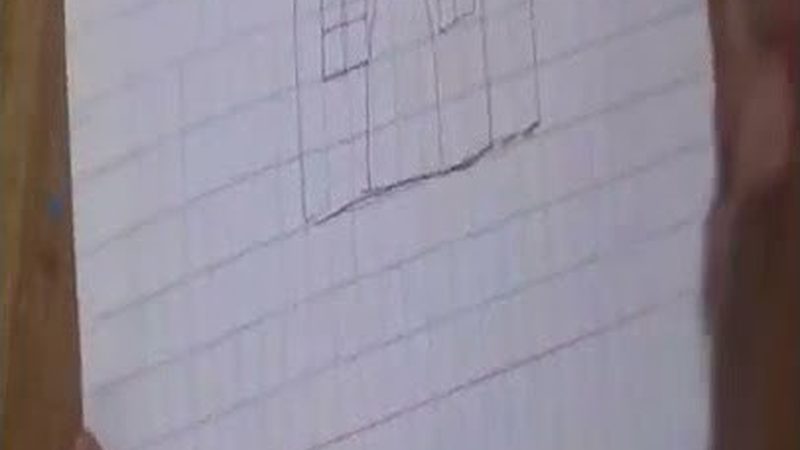 根管治疗后的牙套，2025年得花多少钱